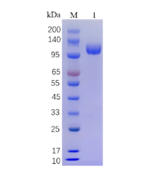 Recombinant Human Sflt-1 protein on SDS-PAGE under reducing (R) condition. The purity of the protein is greater than 90%.